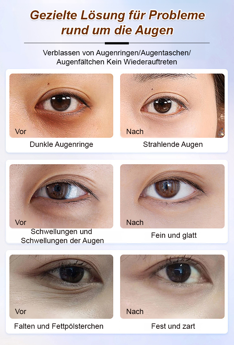 Anti-Aging Augenserum für jugendliches Aussehen