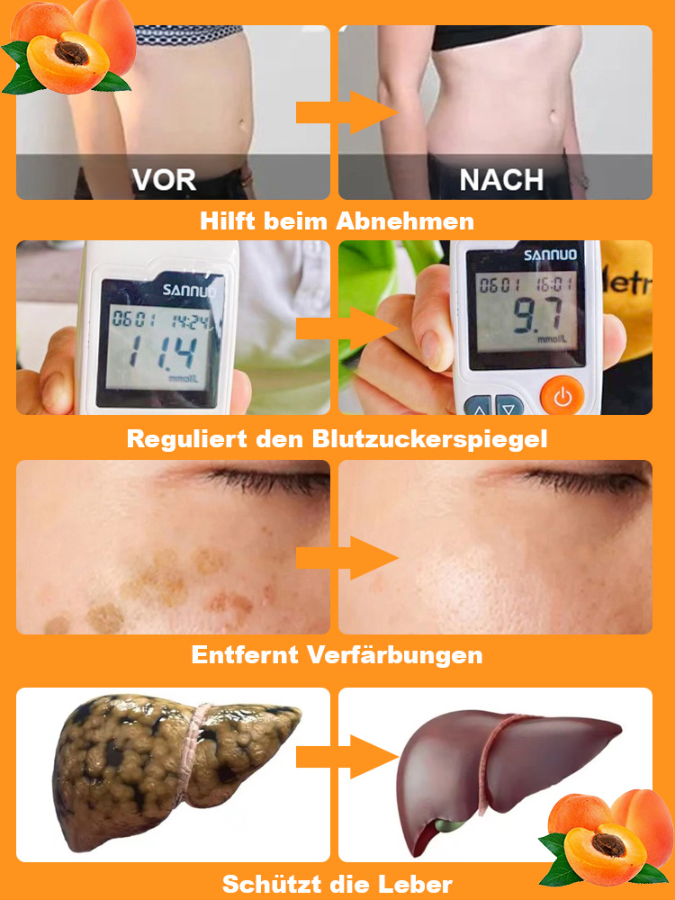 【Extra große Imperial-Aprikose】Ertragreiche, winterharte Aprikosenbaum-Setzlinge