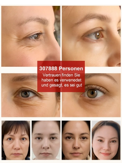 【Rollende feine Linien】Lutein Augenstraffende Essenzöl