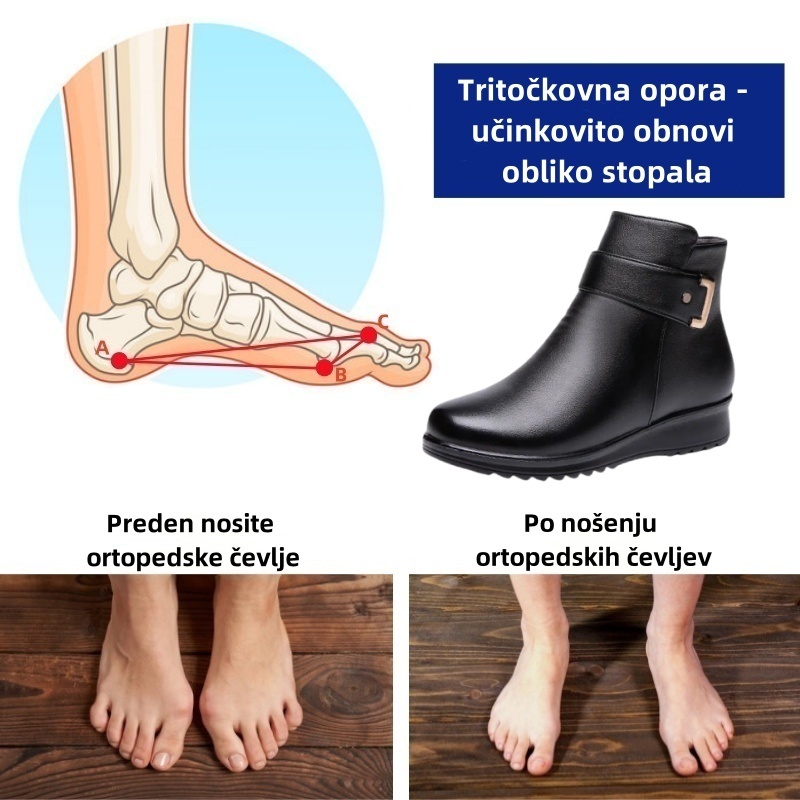 Fiippy® - Ergonomski, vodoodporni, usnjeni ortopedski čevlji za lajšanje bolečin - Nova zimska kolekcija