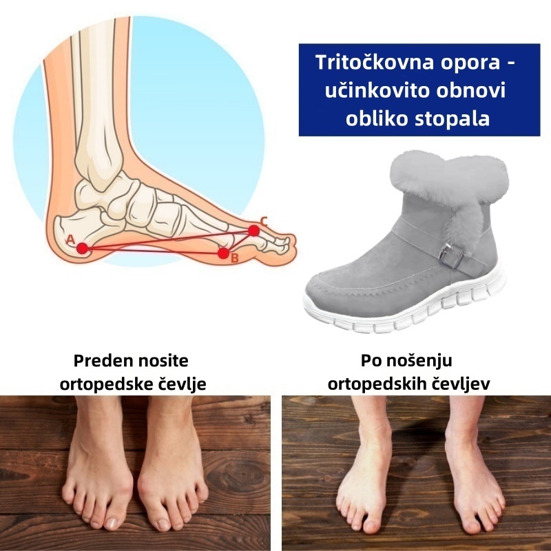 Fiippy® - Ergonomski zimski ortopedski čevlji za lajšanje bolečin v stopalih, kolenih in hrbtu - Ženski