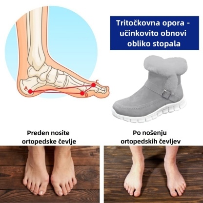 Fiippy® - Ergonomski zimski ortopedski čevlji za lajšanje bolečin v stopalih, kolenih in hrbtu - Ženski