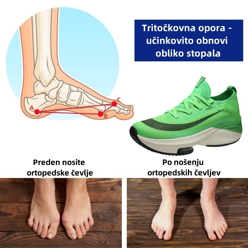 Ortopedski čevlji Fiippy® – ergonomsko oblikovani za bolečine v hrbtu, stopalih in sklepih – unisex