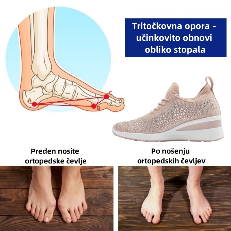 Ženski ortopedski čevlji Fiippy® | Ergonomsko oblikovani za lajšanje bolečin v hrbtu, sklepih in stopalih ter zagotavljajo vrhunsko udobje.