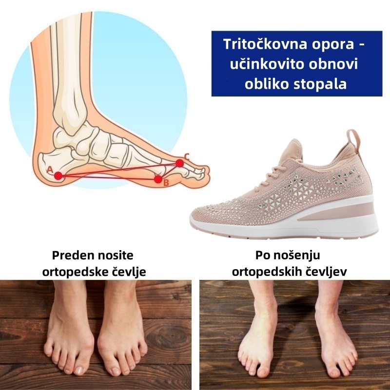 Ženski ortopedski čevlji Fiippy® | Ergonomsko oblikovani za lajšanje bolečin v hrbtu, sklepih in stopalih ter zagotavljajo vrhunsko udobje.