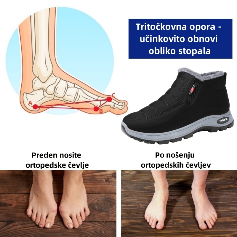 Fiippy® - Ergonomski zimski ortopedski čevelj za bolečine v stopalih, kolenih in hrbtu - Unisex