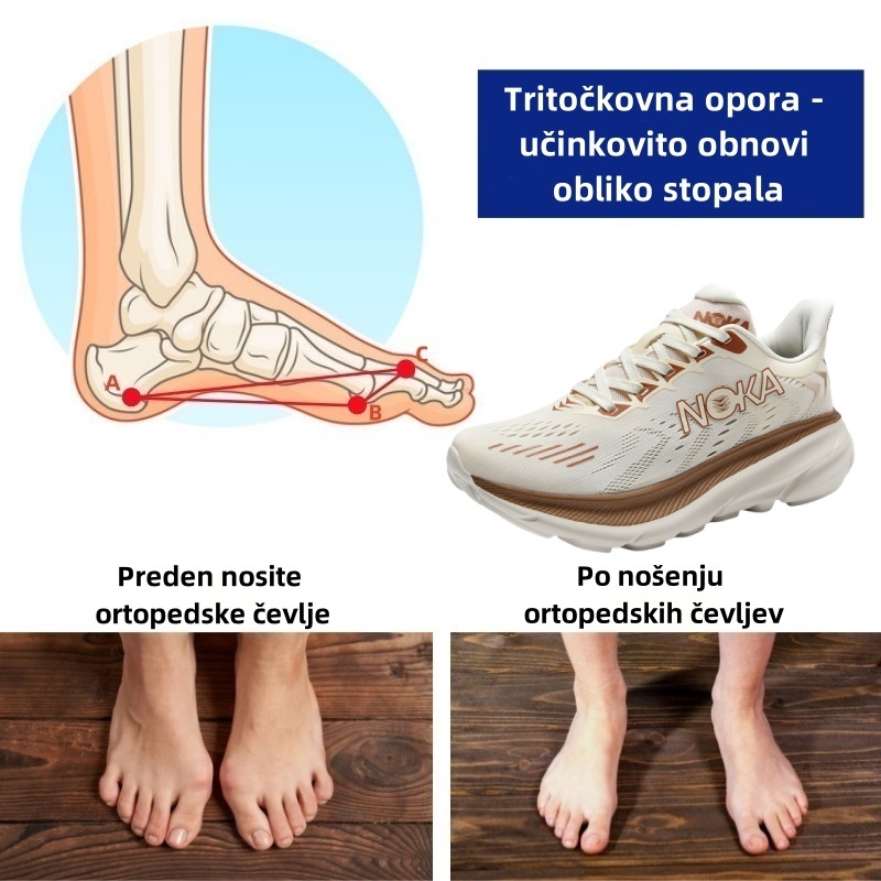 🔥Zadnji dan! Polovična cena! ⏰ Luksuzni ortopedski čevlji, ergonomsko oblikovani ✅ Mehki, udobni in z odlično oporo 🦶 - Učinkovito lajšajo bolečine v stopalih