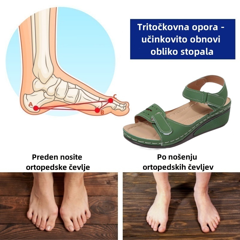 🔥Časno omejen 50 % popust! Poletni ortopedski sandali, ergonomsko oblikovani za udobje in lajšanje bolečin✅