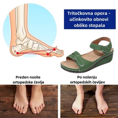 🔥Časno omejen 50 % popust! Poletni ortopedski sandali, ergonomsko oblikovani za udobje in lajšanje bolečin✅