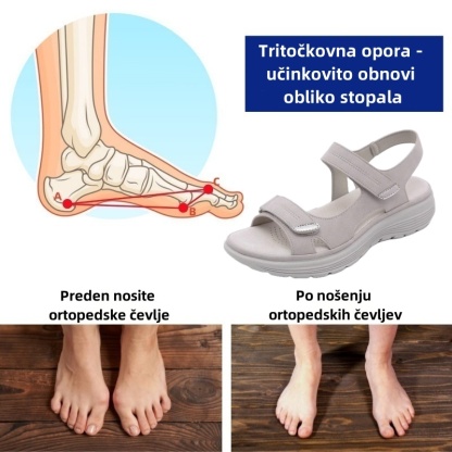 🔥Časno omejen 50 % popust! Poletni ortopedski sandali, ergonomsko oblikovani za udobje in lajšanje bolečin✅