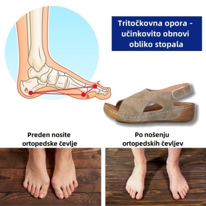 🔥Časno omejen 50 % popust! Poletni ortopedski sandali, ergonomsko oblikovani za udobje in lajšanje bolečin✅