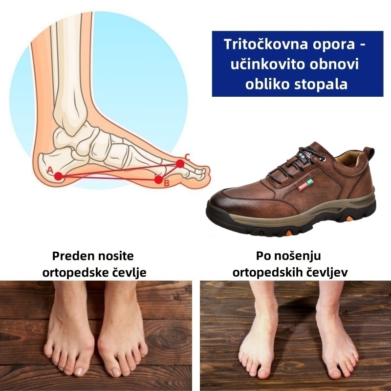 🔥 Danes za polovično ceno! Ne zamudite! ⏰ Ergonomsko oblikovani ortopedski čevlji - zagotavljajo naravno oporo stopalnega loka 👞 Z lahkoto lajšajo bolečine v stopalih