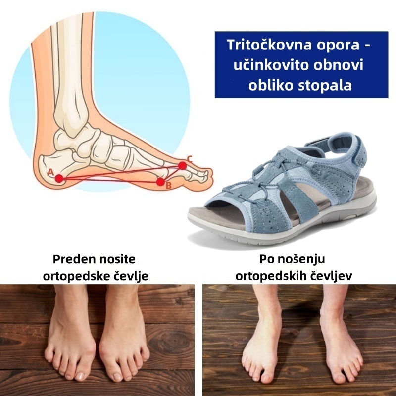 🔥Časno omejen 50 % popust! Poletni ortopedski sandali, ergonomsko oblikovani za udobje in lajšanje bolečin✅