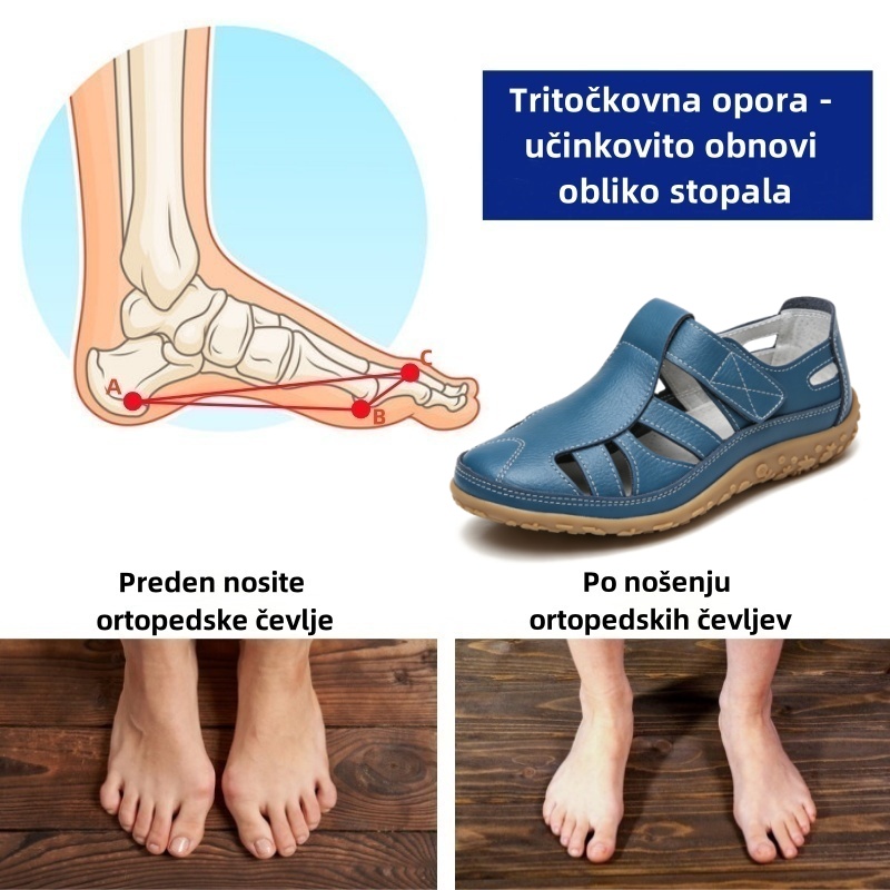 🔥Časno omejen 50 % popust! Poletni ortopedski sandali, ergonomsko oblikovani za udobje in lajšanje bolečin✅