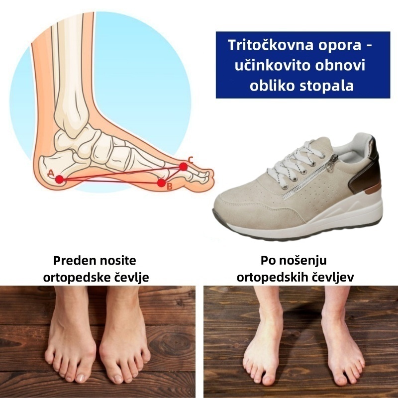 🔥 Danes za polovično ceno! Ne zamudite! ⏰ Ergonomsko oblikovani ortopedski čevlji - zagotavljajo naravno oporo stopalnega loka 👞 Z lahkoto lajšajo bolečine v stopalih