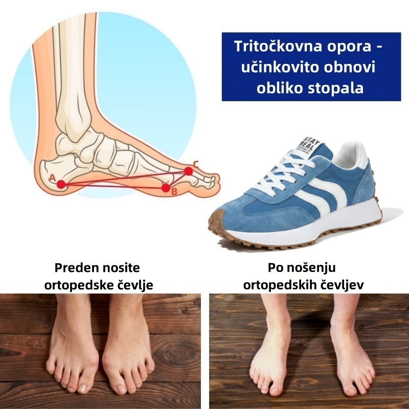 🔥 Danes za polovično ceno! Ne zamudite! ⏰ Ergonomsko oblikovani ortopedski čevlji - zagotavljajo naravno oporo stopalnega loka 👞 Z lahkoto lajšajo bolečine v stopalih