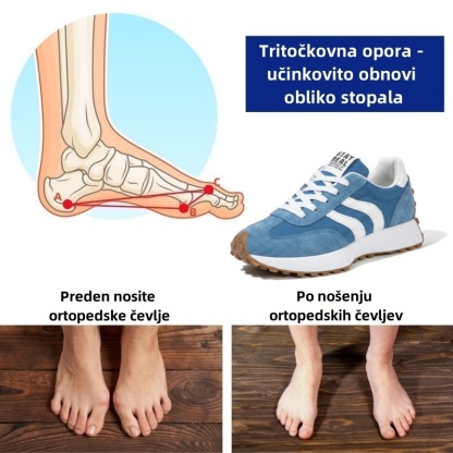 🔥 Danes za polovično ceno! Ne zamudite! ⏰ Ergonomsko oblikovani ortopedski čevlji - zagotavljajo naravno oporo stopalnega loka 👞 Z lahkoto lajšajo bolečine v stopalih