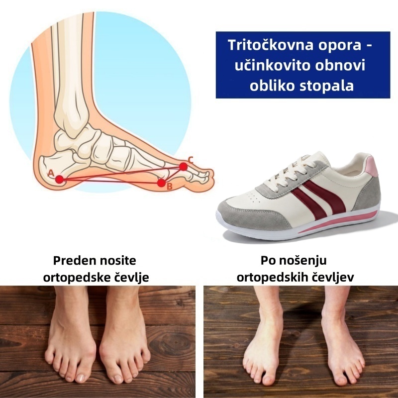 🔥 Danes za polovično ceno! Ne zamudite! ⏰ Ergonomsko oblikovani ortopedski čevlji - zagotavljajo naravno oporo stopalnega loka 👞 Z lahkoto lajšajo bolečine v stopalih