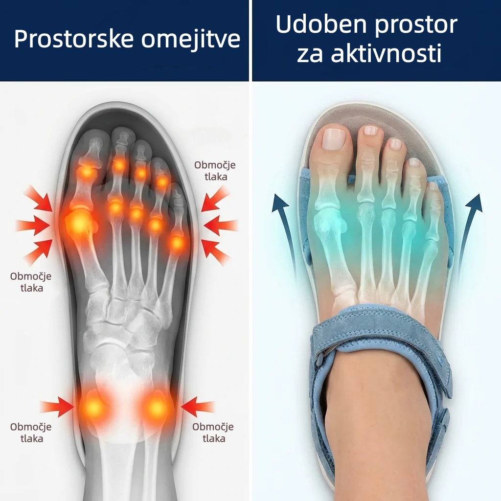 🔥Časno omejen 50 % popust! Poletni ortopedski sandali, ergonomsko oblikovani za udobje in lajšanje bolečin✅