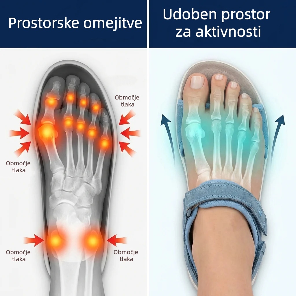 🔥Časno omejen 50 % popust! Poletni ortopedski sandali, ergonomsko oblikovani za udobje in lajšanje bolečin✅