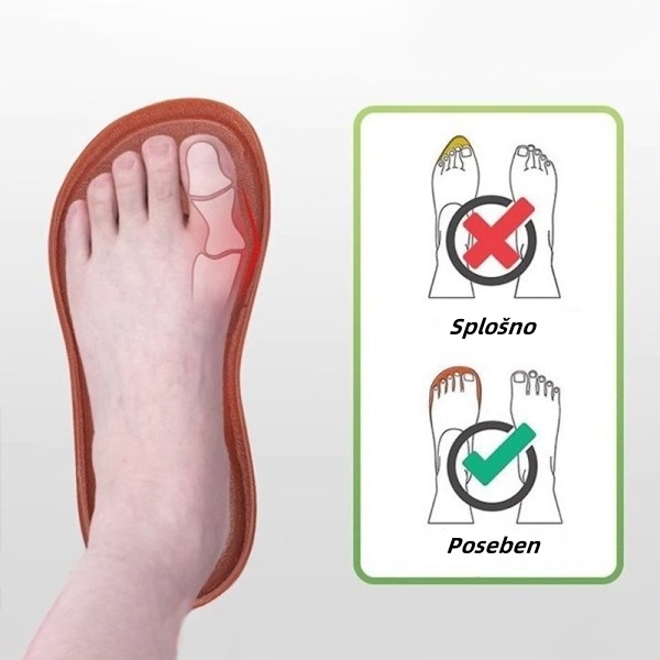 ⏰ Današnji 50 % popust - poletni ortopedski sandali na klin - lajšanje bolečin v stopalih