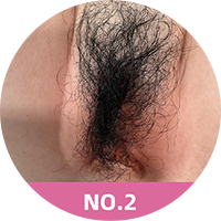 Dollslover All-Silicone Realistic Sex Doll with Natural Eye & Lip Design