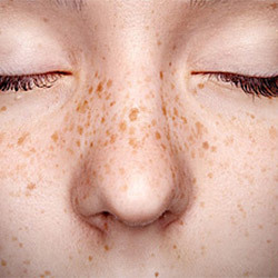 Add Moles & Freckles-DollsLover Official Store