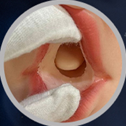 Euhanced Mouth (FREE)