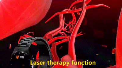 1699362794206094.gif 无创测血糖.gif