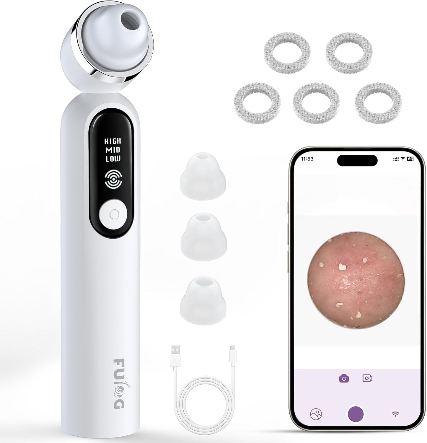【UK】Facial Pore Vacuum Suction Cleane with 3 Suction Heads for Thorough Deep Pore Cleansing, Blackhead Excision & Personal Skincare Nurturing.