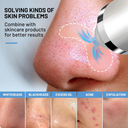 【UK】Facial Pore Vacuum Suction Cleane with 3 Suction Heads for Thorough Deep Pore Cleansing, Blackhead Excision & Personal Skincare Nurturing.