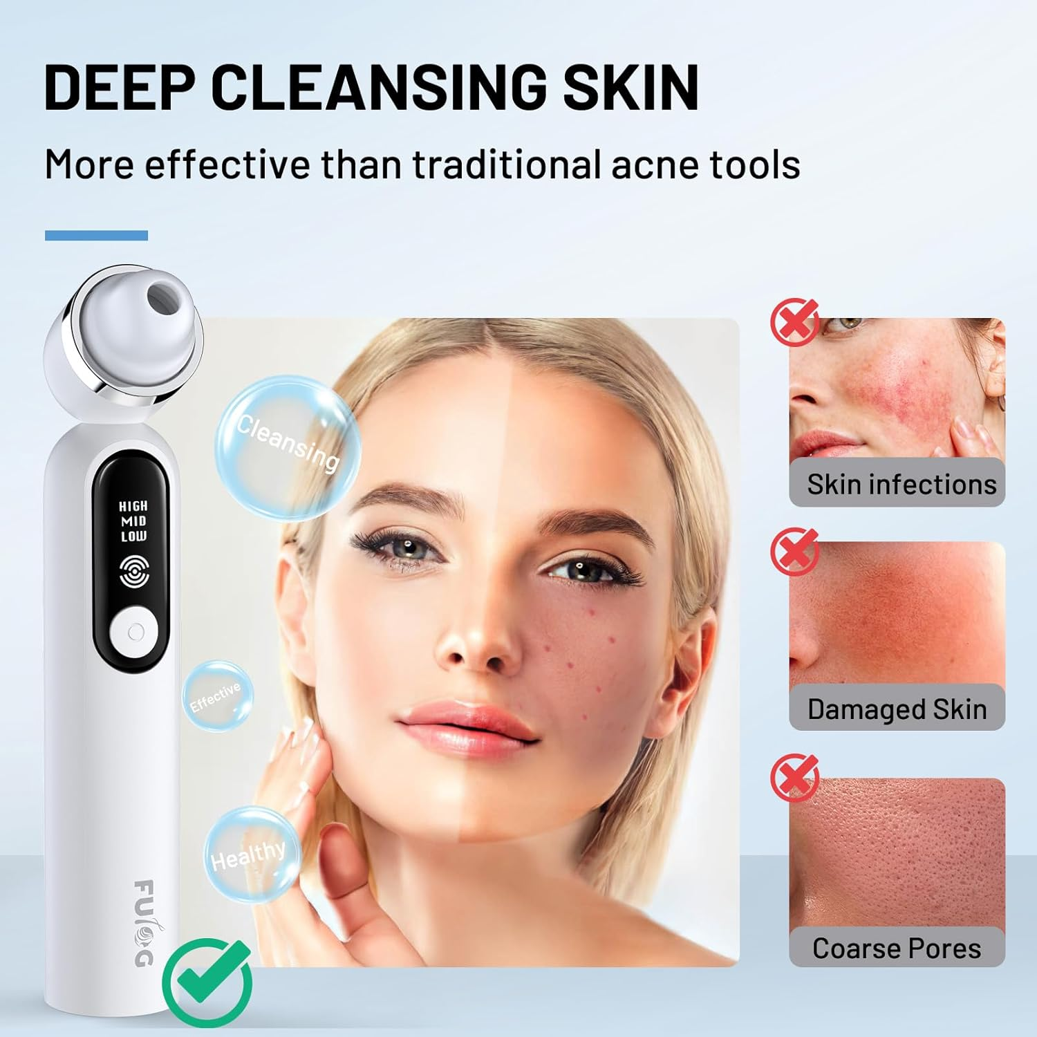 【UK】Facial Pore Vacuum Suction Cleane with 3 Suction Heads for Thorough Deep Pore Cleansing, Blackhead Excision & Personal Skincare Nurturing.