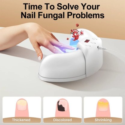 Dispositivo láser para hongos en las uñas de los pies y de las manos Solución reparadora de uñas dañadas y descoloridas para uso doméstico