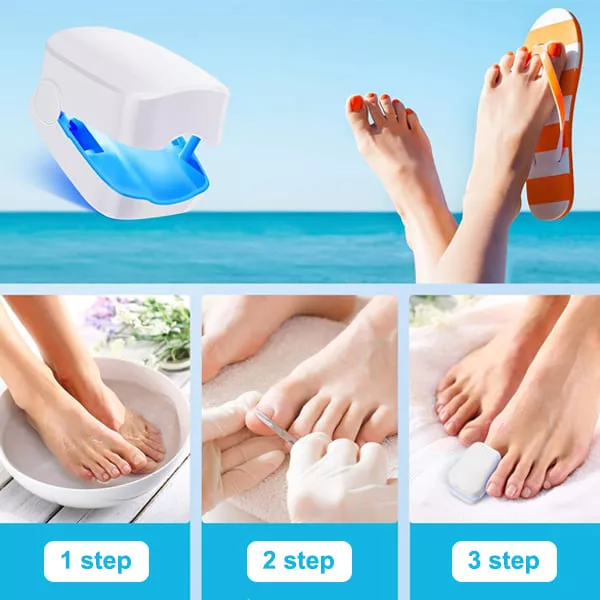 Dispositivo Láser para Limpiar Hongos en Uñas