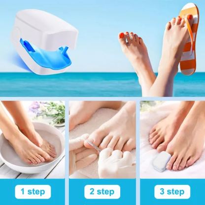 Dispositivo Láser para Limpiar Hongos en Uñas