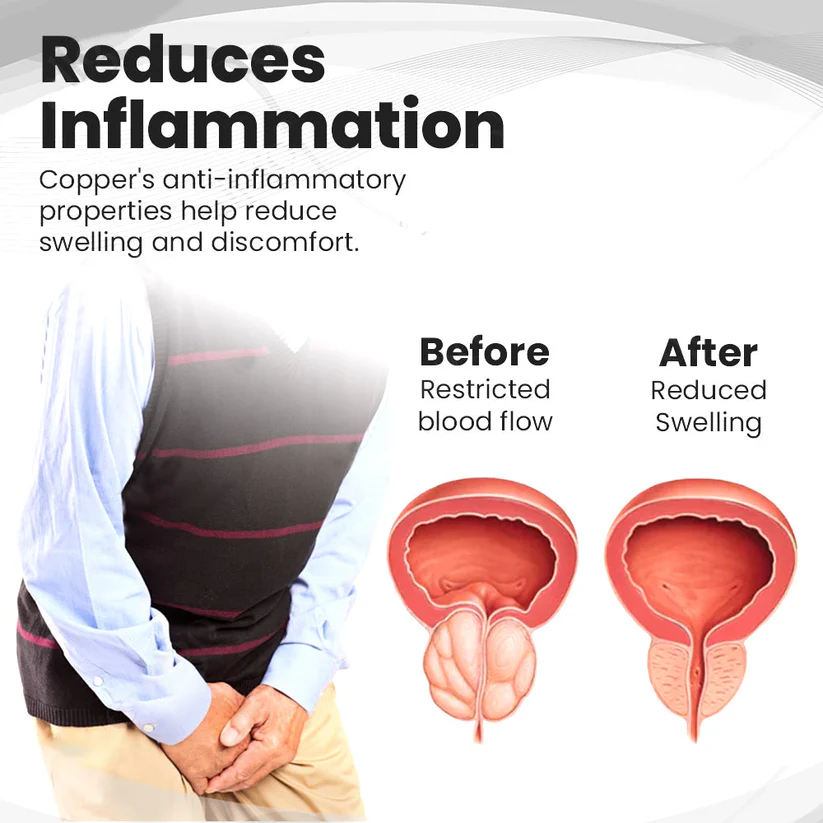 🎇 Histone™ Copper Mag Prsten na terapii prostaty – 50% sleva