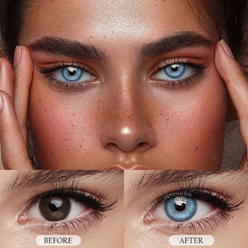 MYEYEBB Rare Iris Blue Verschreibungspflichtige Farbkontaktlinsen - image 4