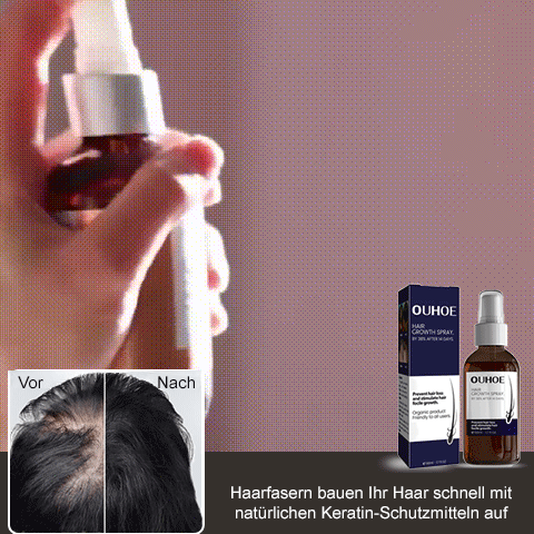 🔥Hot sale 49%OFF🔥Natural Hair Regrowth Spray