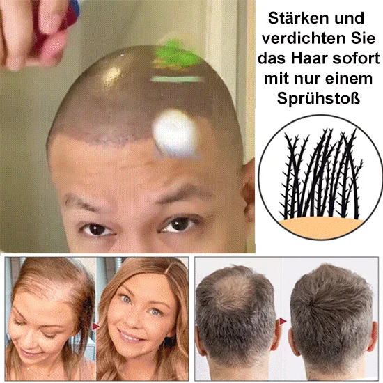 🔥Hot sale 49%OFF🔥Natural Hair Regrowth Spray