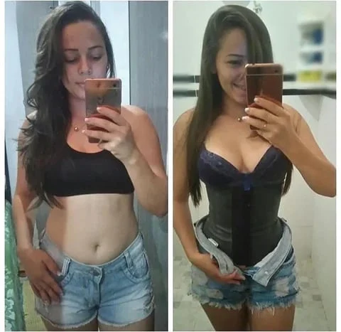 🔥LAST DAY 65% OFF🔥Snatch Bra - 3-in-1 Waist Trainer Bra