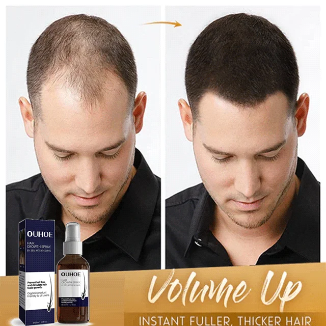 🔥Hot sale 49%OFF🔥Natural Hair Regrowth Spray