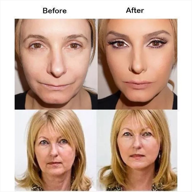 🔥LAST DAY-49%OFF🔥New Ultra Invisible Waterproof Face Lift Stickers C