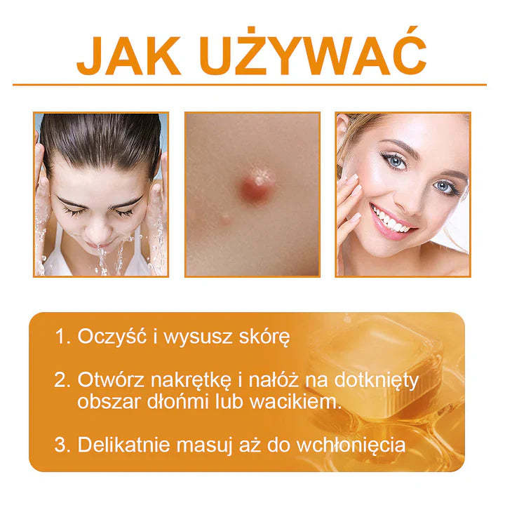 【🌊 Za pobraniem🌊 】 Vsoxa™ Krem do usuwania brodawek i pieprzyków z jadem pszczelim (👨⚕Zalecenia AAD) 🐝🐝 (🔥Ostatni dzień wyprzedaży 70% taniej)