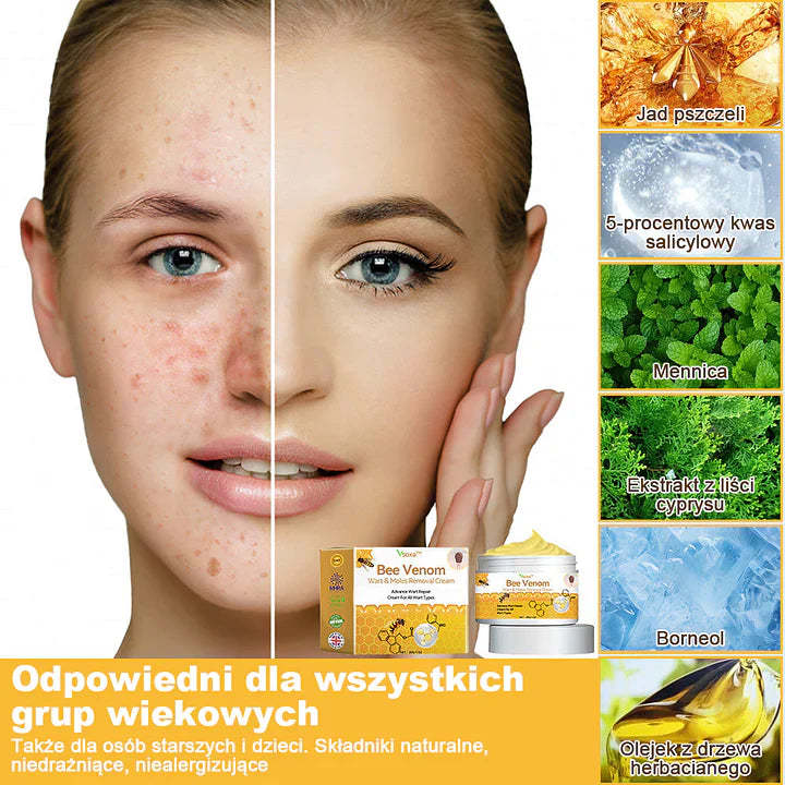 【🌊 Za pobraniem🌊 】 Vsoxa™ Krem do usuwania brodawek i pieprzyków z jadem pszczelim (👨⚕Zalecenia AAD) 🐝🐝 (🔥Ostatni dzień wyprzedaży 70% taniej)