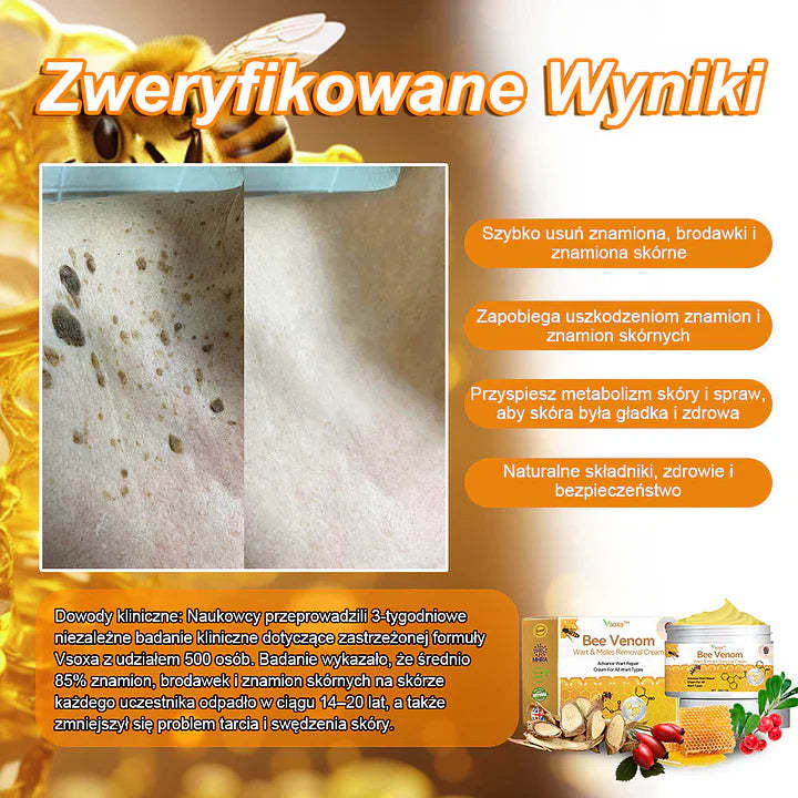 【🌊 Za pobraniem🌊 】 Vsoxa™ Krem do usuwania brodawek i pieprzyków z jadem pszczelim (👨⚕Zalecenia AAD) 🐝🐝 (🔥Ostatni dzień wyprzedaży 70% taniej)