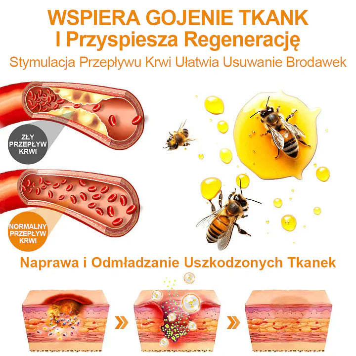【🌊 Za pobraniem🌊 】 Vsoxa™ Krem do usuwania brodawek i pieprzyków z jadem pszczelim (👨⚕Zalecenia AAD) 🐝🐝 (🔥Ostatni dzień wyprzedaży 70% taniej)