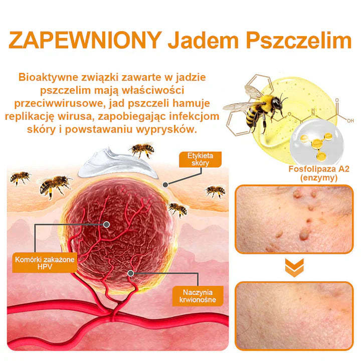 【🌊 Za pobraniem🌊 】 Vsoxa™ Krem do usuwania brodawek i pieprzyków z jadem pszczelim (👨⚕Zalecenia AAD) 🐝🐝 (🔥Ostatni dzień wyprzedaży 70% taniej)