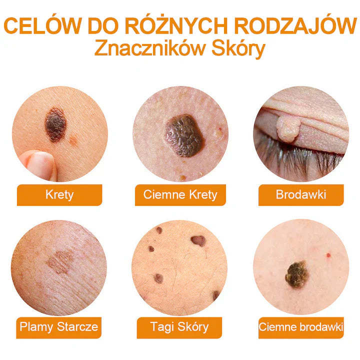【🌊 Za pobraniem🌊 】 Vsoxa™ Krem do usuwania brodawek i pieprzyków z jadem pszczelim (👨⚕Zalecenia AAD) 🐝🐝 (🔥Ostatni dzień wyprzedaży 70% taniej)