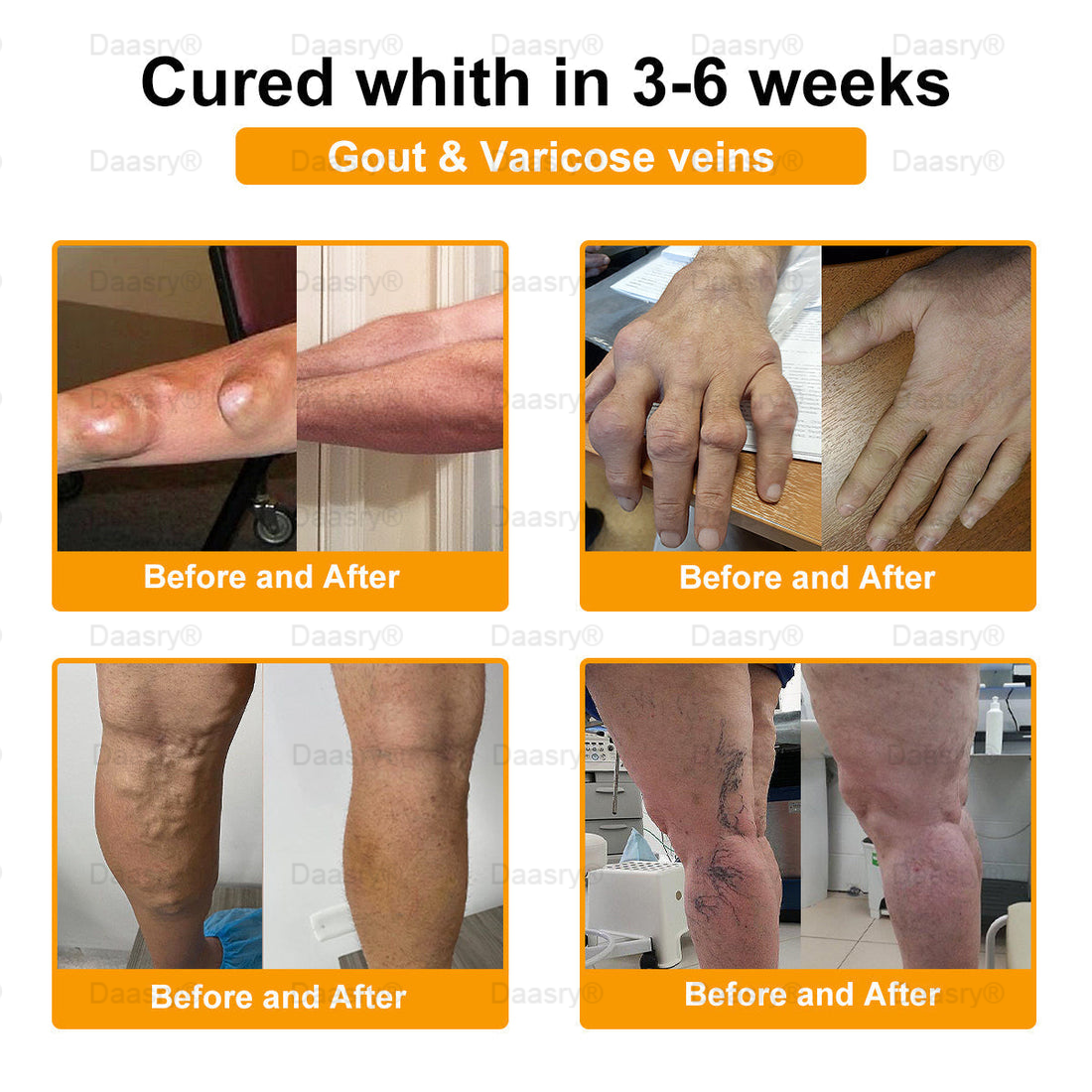 ArthroEase Bee Venom Arthritis Therapy Cream(Specially for older adults & AAOS recommends)