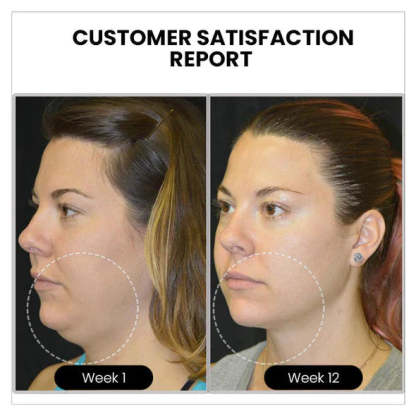 DIYSTAR Magnetology Lymphvity Germanium Earrings（Limited Time Discount 🔥 Last Day）